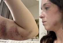 Comissária de bordo é presa em Dubai após denunciar marido por violência