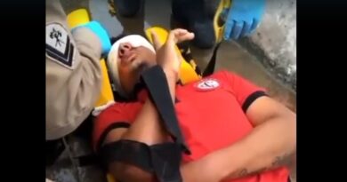 Torcedor é baleado no olho no estádio Amigão durante jogo do Campinense e Bahia pela Copa do Nordeste